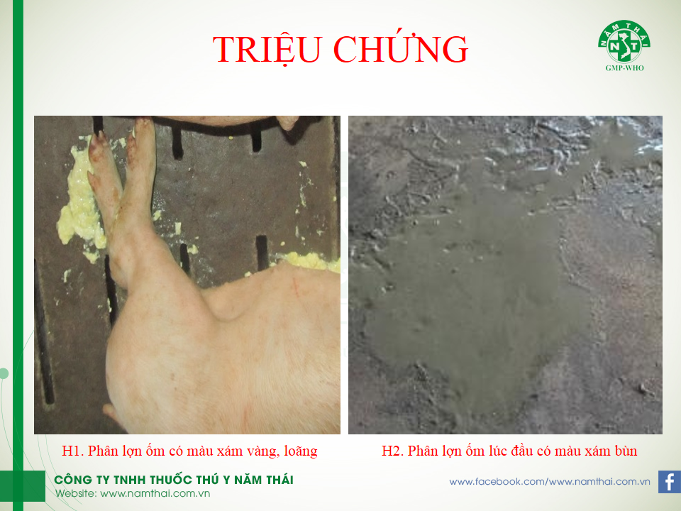 DỊCH TIÊU CHẢY CẤP (PED)